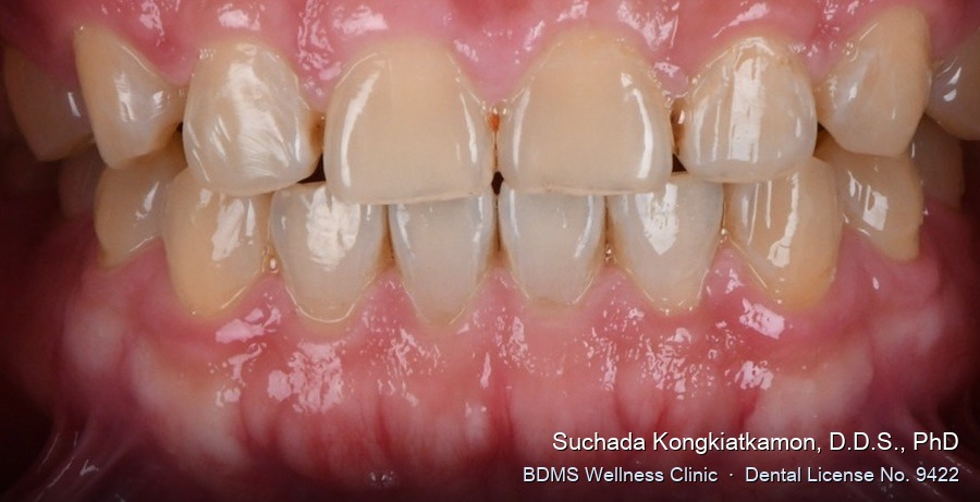 Case 08 before