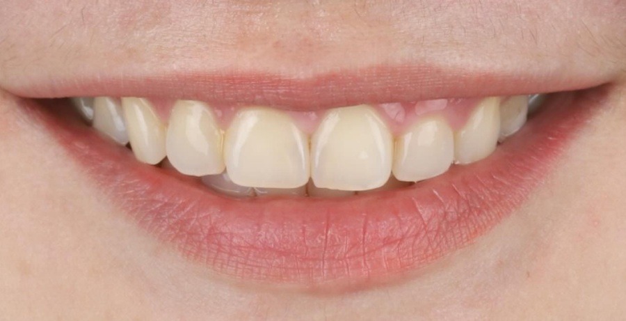 Case 36 before