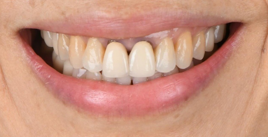 Case 02 before