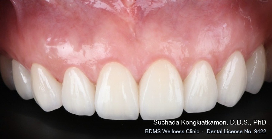 Case 07 after