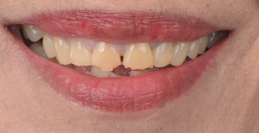 Case 23 before