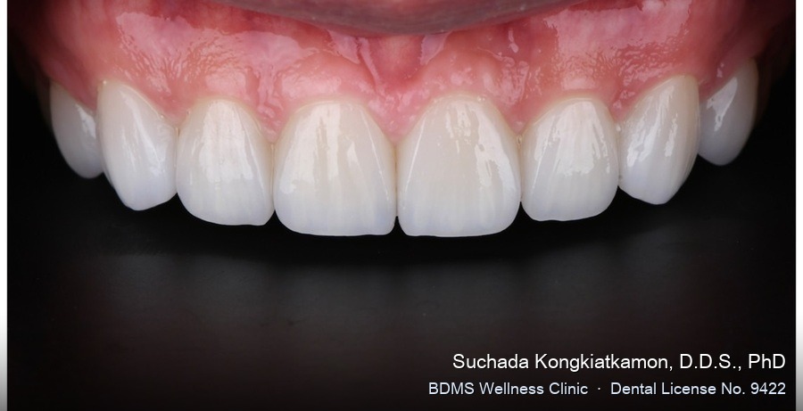 Case 10 after