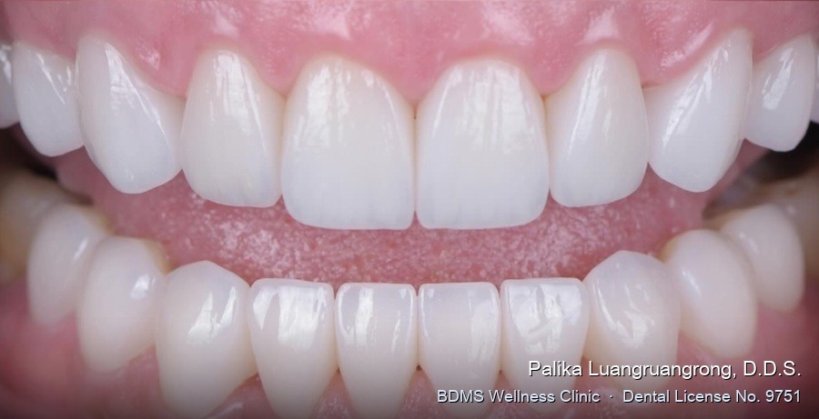 Case 28 after