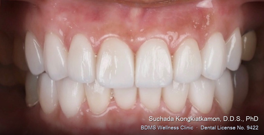 Case 16 after