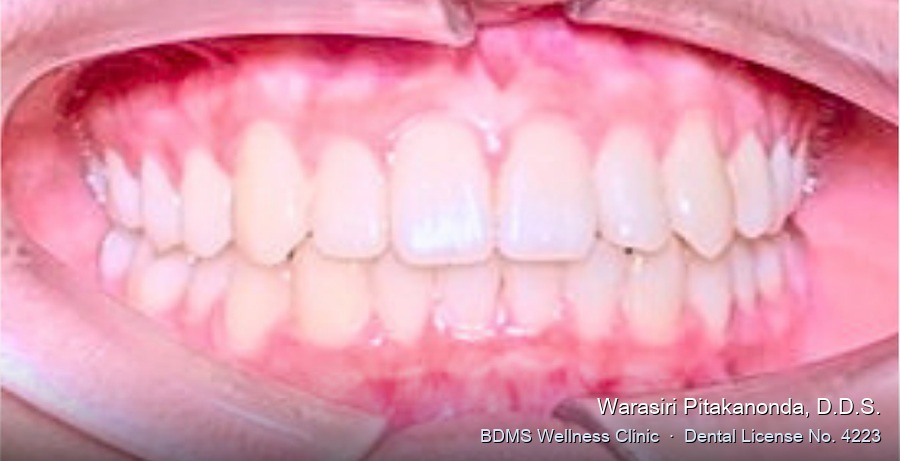 Case 08 after