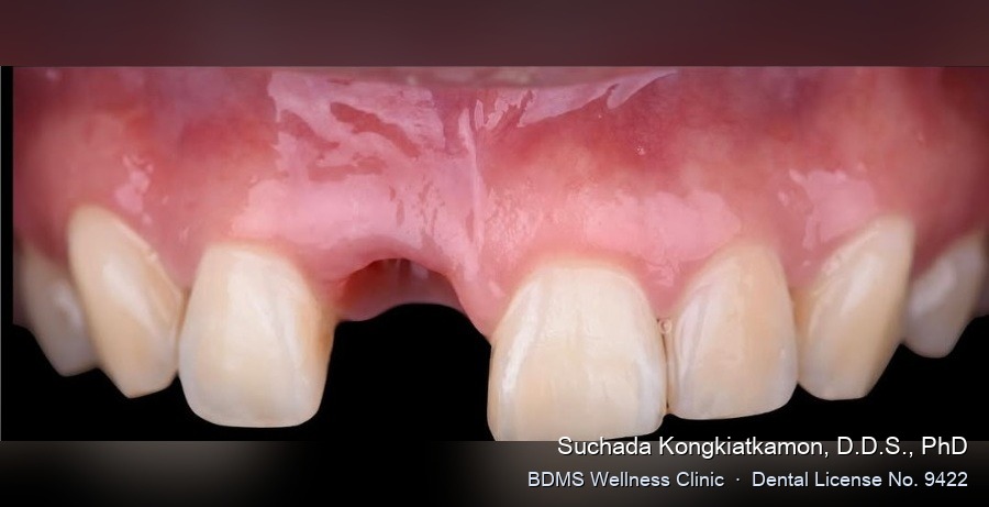 Case 02 before