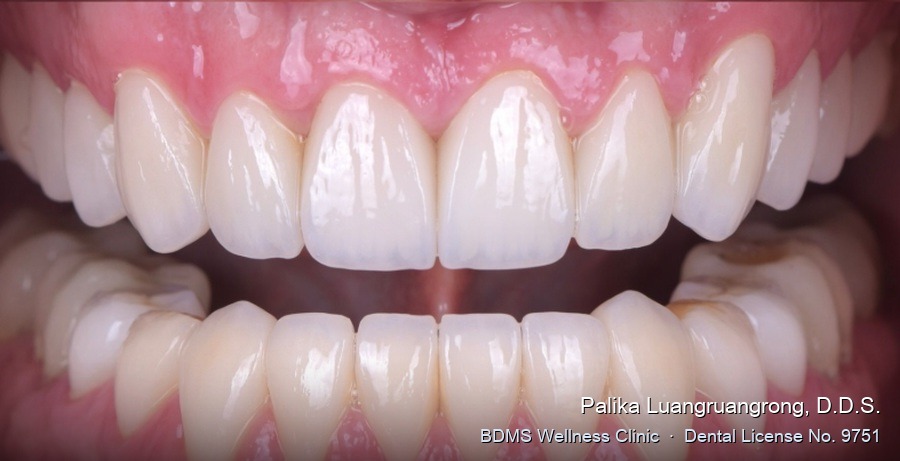 Case 21 after