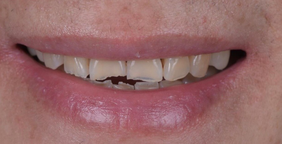 Case 29 before