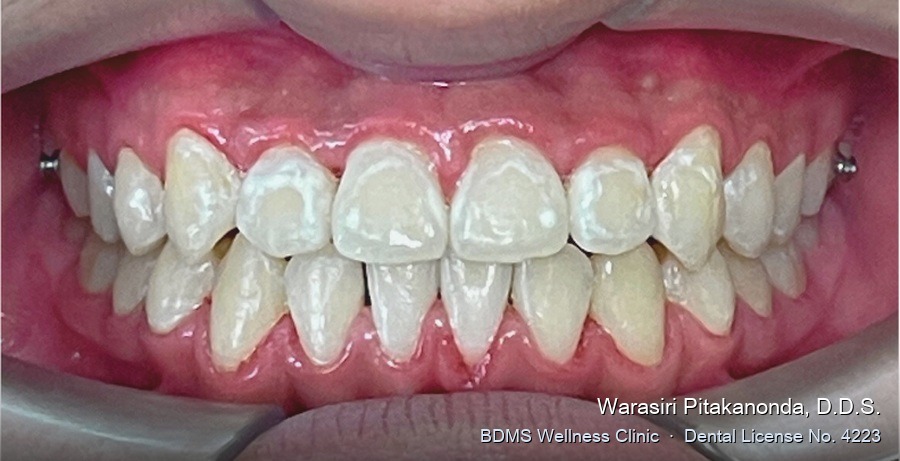 Case 10 after