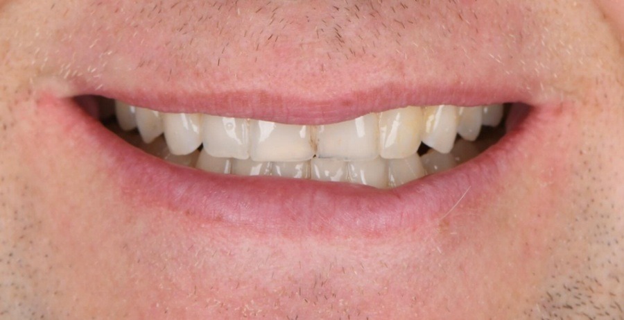 Case 24 before