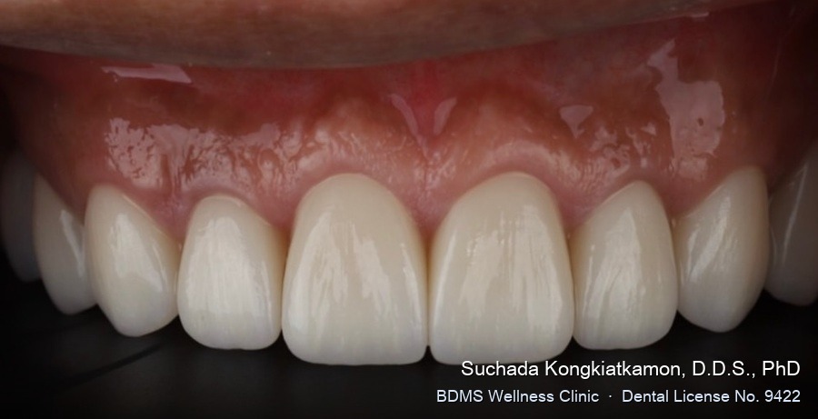 Case 02 after