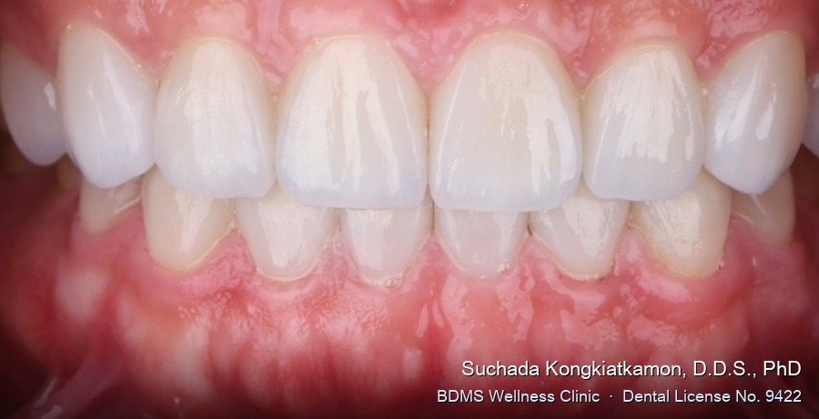 Case 08 after