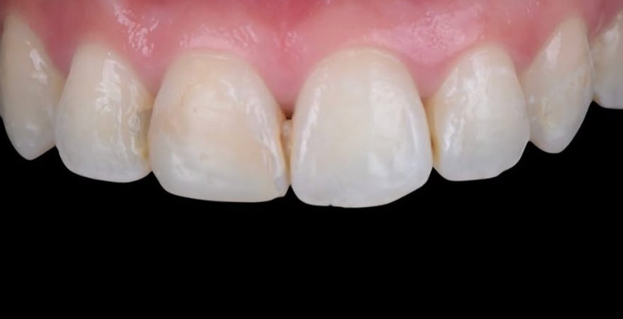 Case 26 before