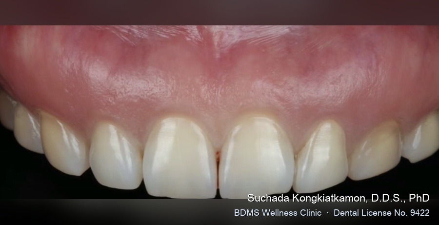 Case 07 before