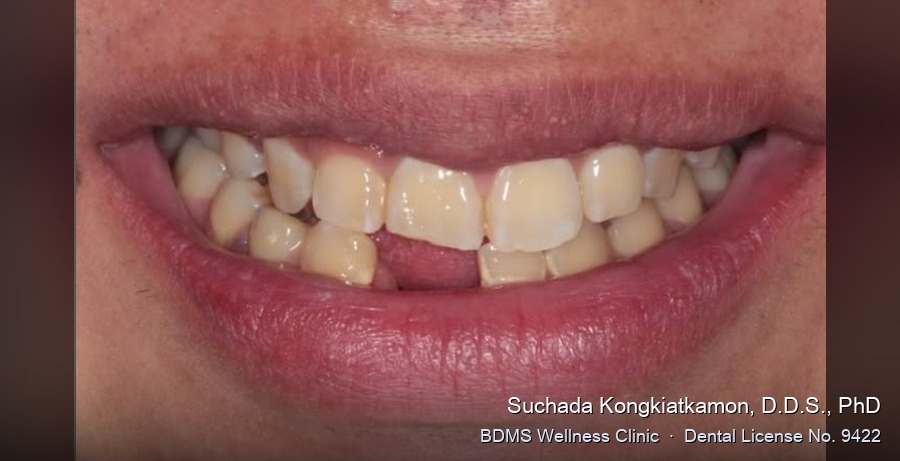 Case 03 before
