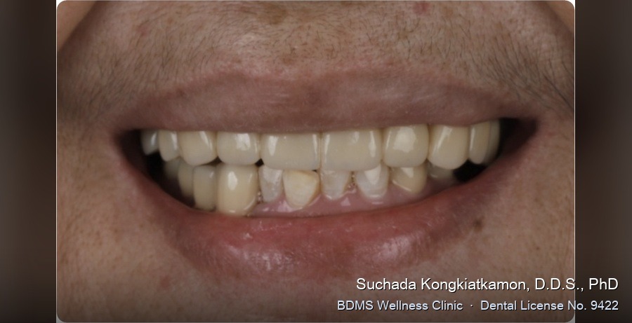Case 01 after