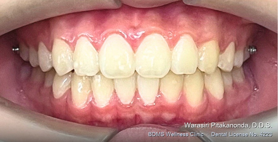 Case 02 after