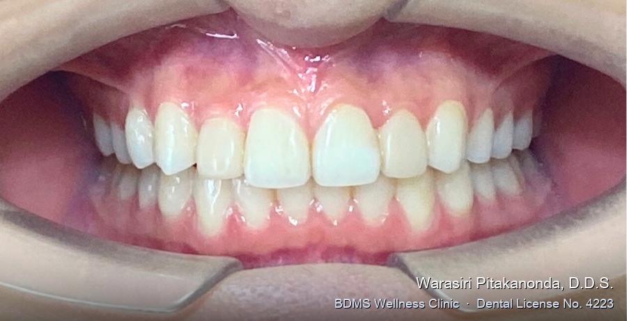 Case 07 after
