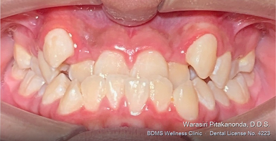 Case 10 before