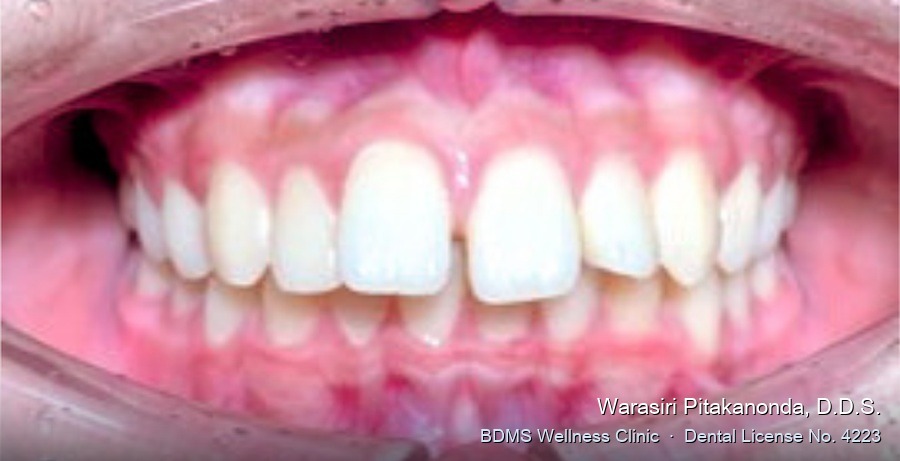 Case 08 before