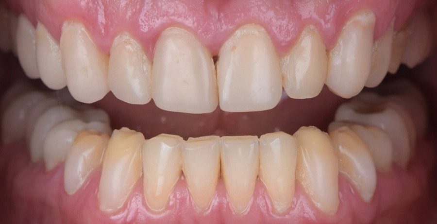 Case 21 before