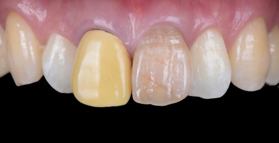 Case 01 before