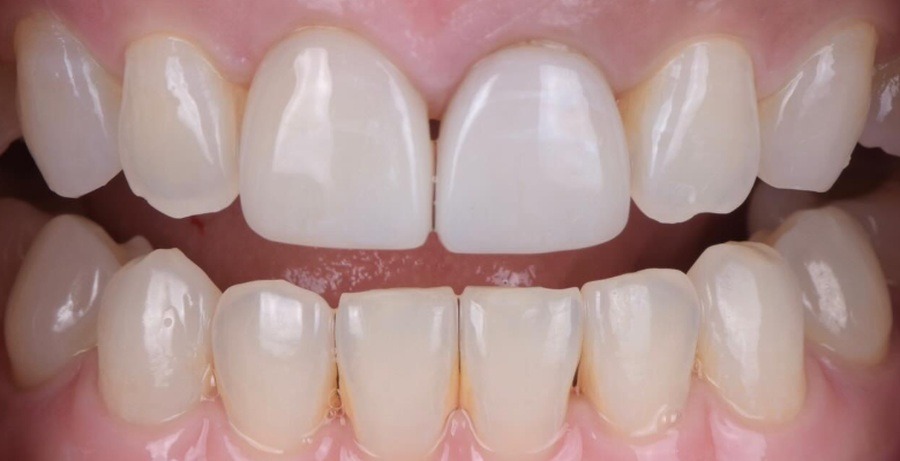 Case 27 before
