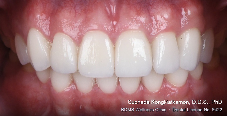 Case 19 after
