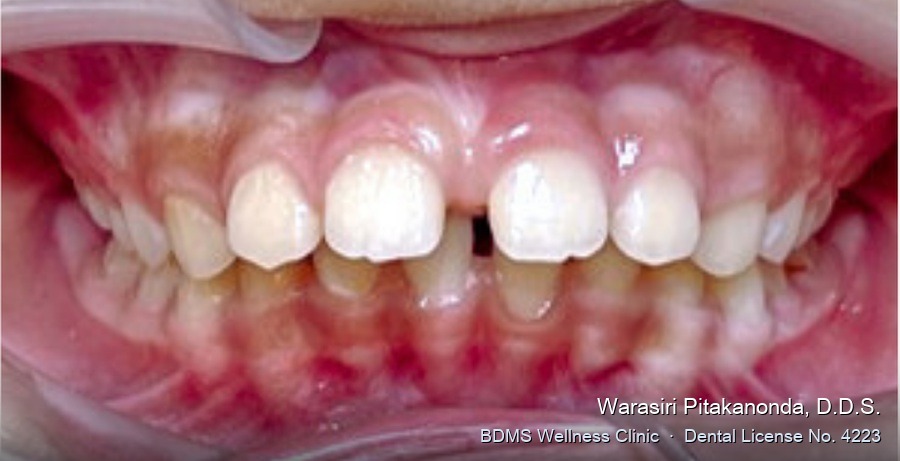Case 09 before