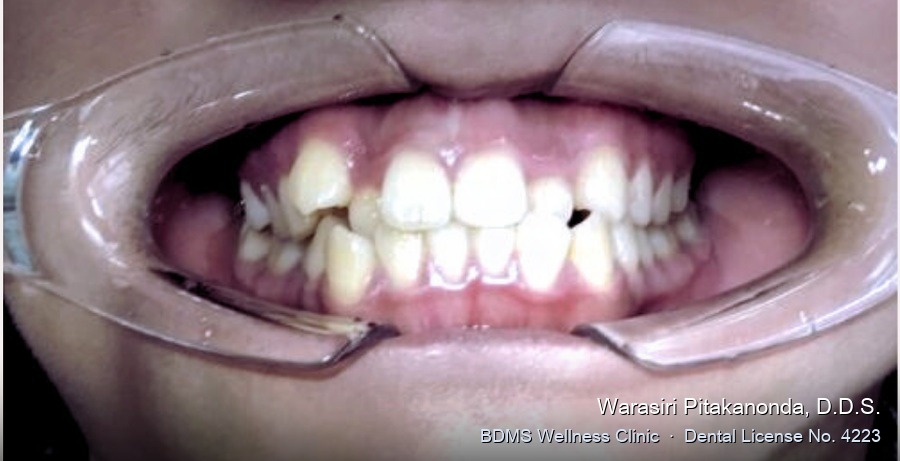 Case 06 before