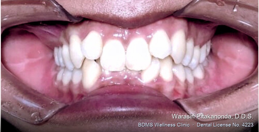 Case 05 before