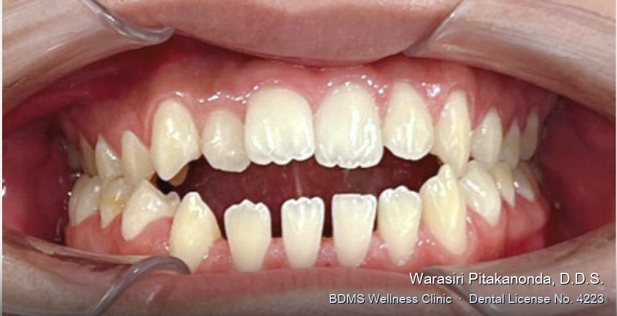 Case 03 before
