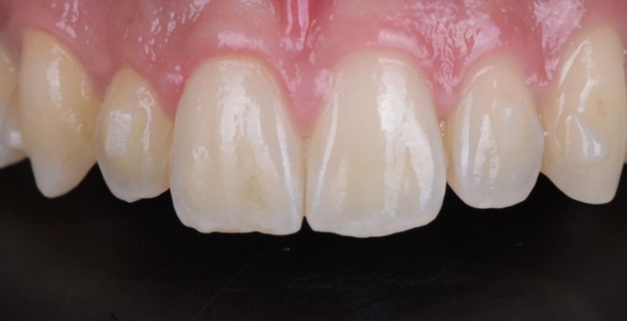 Case 40 before