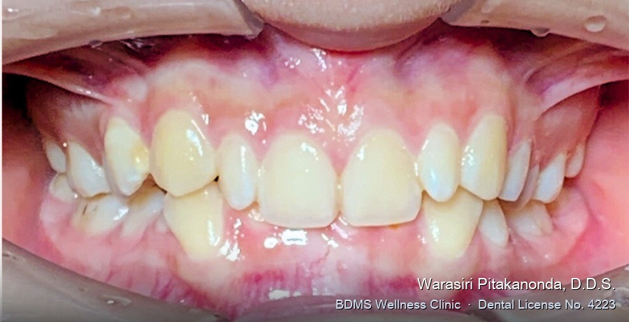 Case 01 before