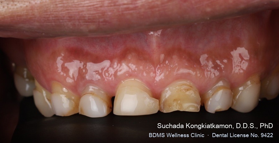 Case 02 before