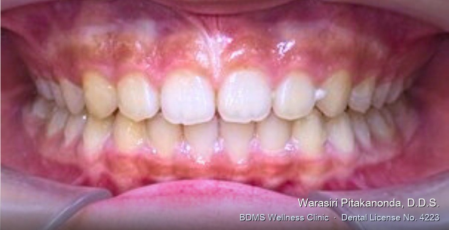 Case 09 after
