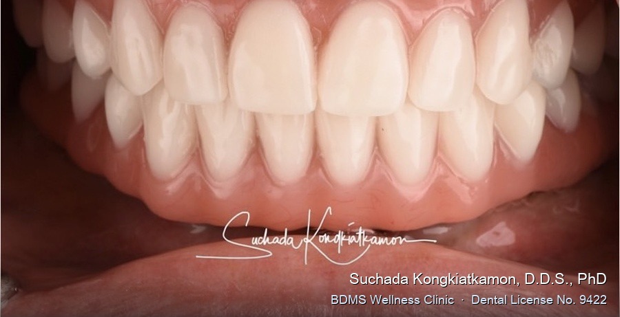 Case 01 after