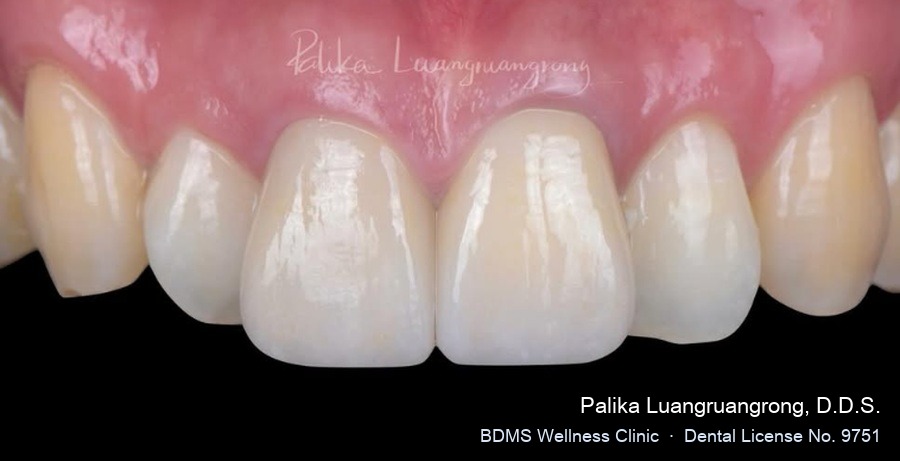 Case 01 after