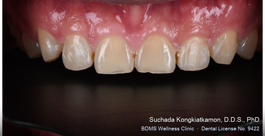 Case 10 before
