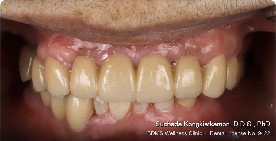 Case 02 after