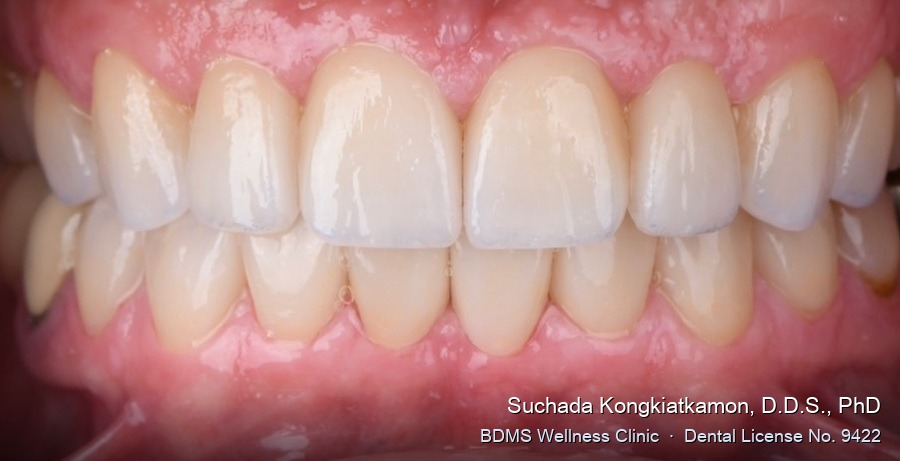 Case 03 after