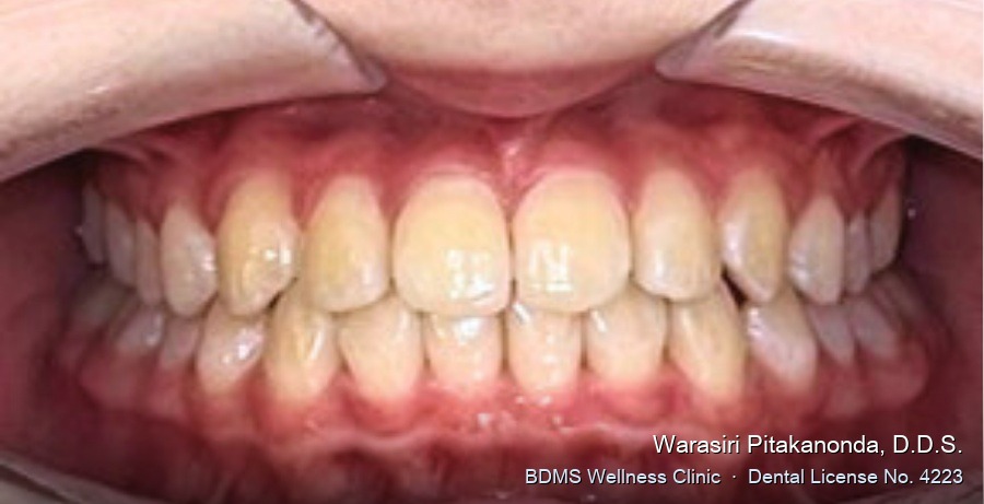 Case 04 after