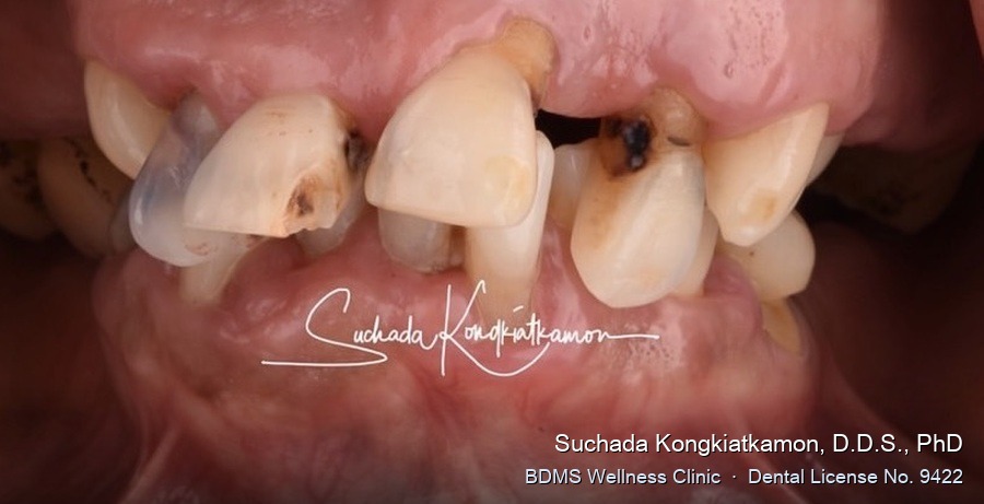 Case 01 before