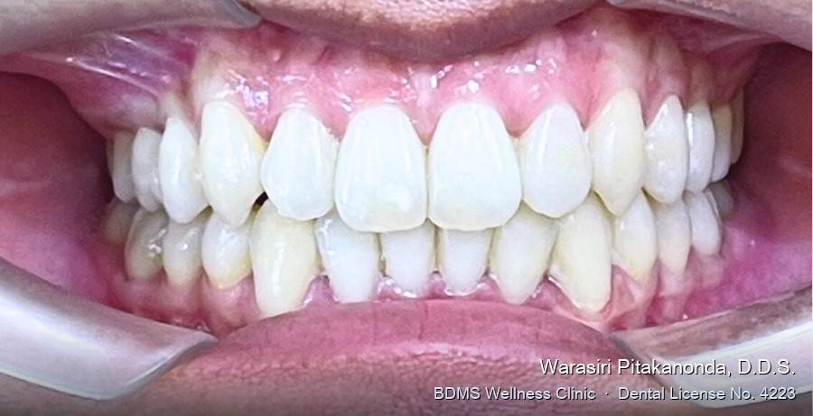 Case 05 after