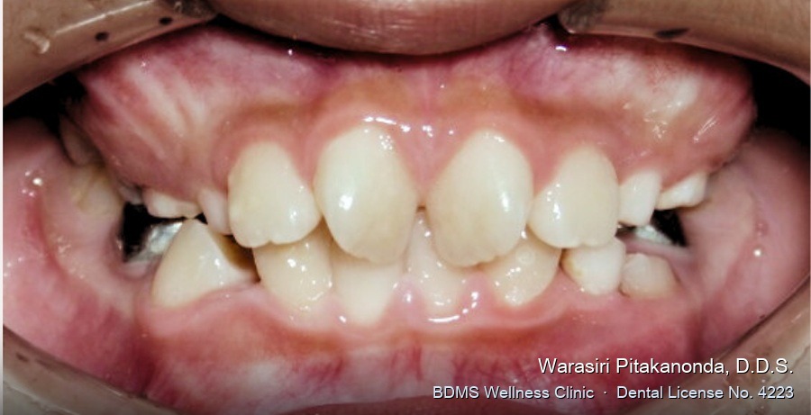 Case 02 before