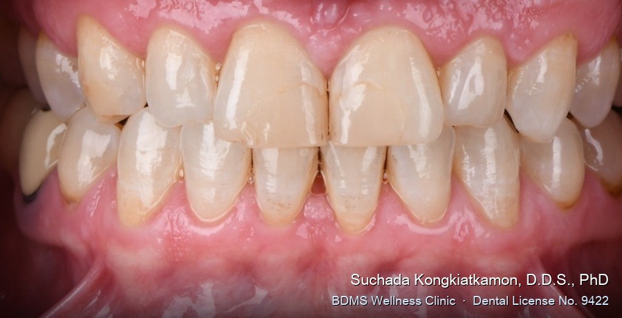 Case 03 before