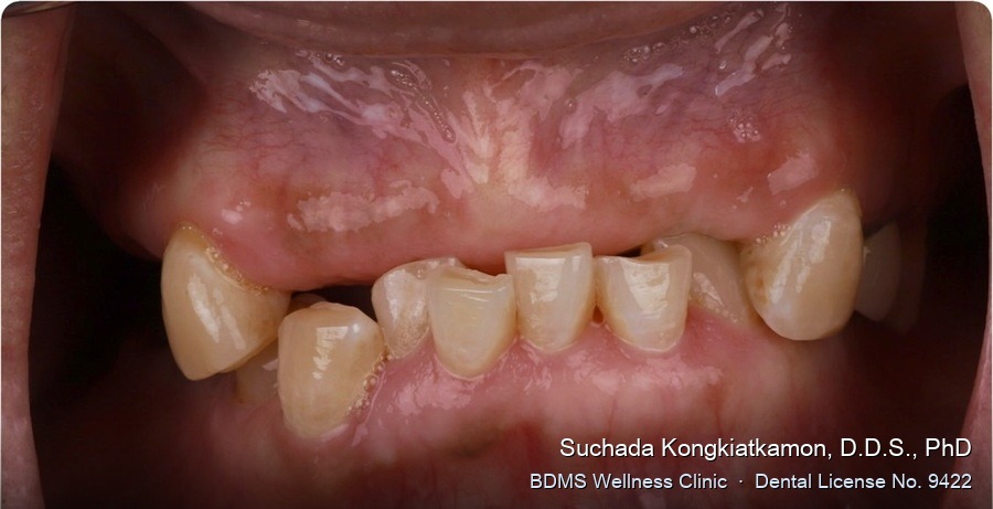 Case 02 before