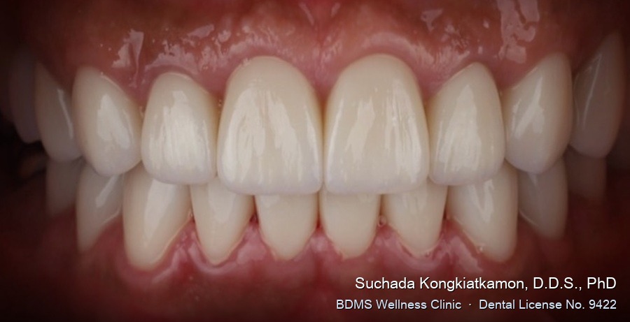 Case 01 after