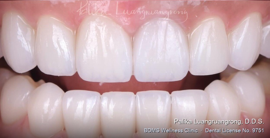Case 27 after