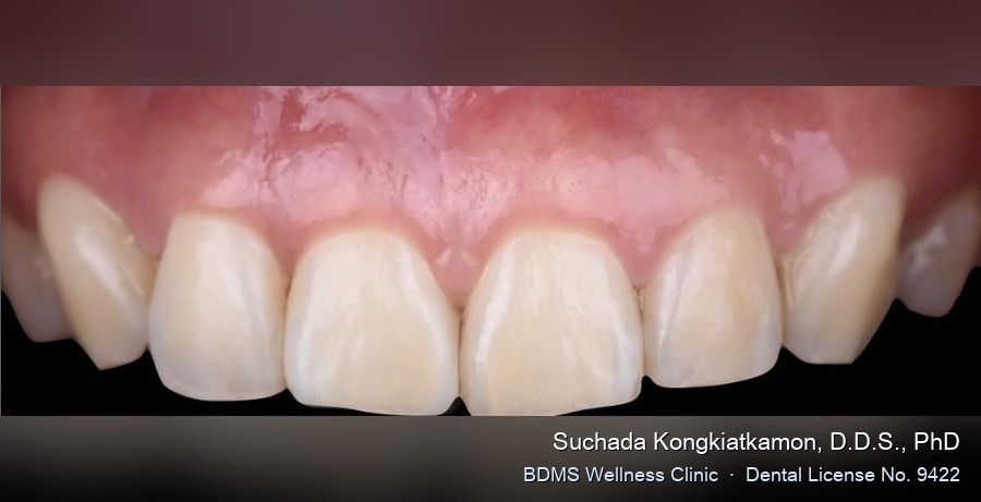 Case 02 after